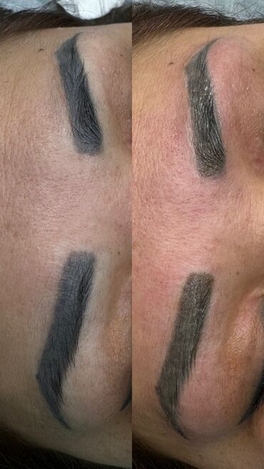 Перманентный макияж: АКЦИЯ !АКЦИЯ! Новый метод удаления Сейчас по акции Лазерное удаление — 14