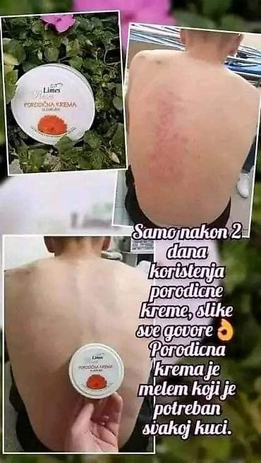 Nega kože: Limes Rosa Porodična krema – kantarion i neven Višenamenska krema za — 11