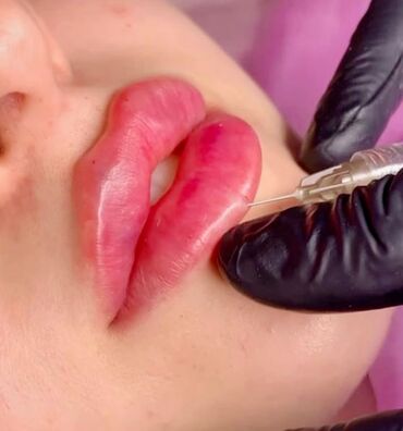 Косметология: Косметология, Биоревитализация, Ботокс, Демодекоз, Гипоаллергенные материалы, Консультация, Сертифицированный косметолог — 18