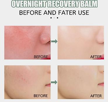 Уход за телом: ❄️ США Крем с керамидами антивозрастной увлажняющий Крем с керамидами — 4