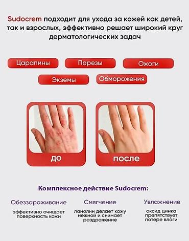 ожог: Sudocrem Antiseptic Healing Cream — антисептический заживляющий крем — 4