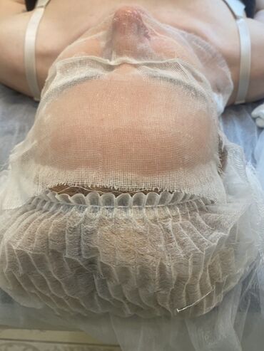 удаление татуажа лазером цена: •Чистки лица: механическая, ультразвуковая, атравматическая