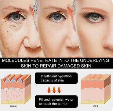 Уход за телом: ❄️ США крем для лица против морщин Аmazon ▶ Увлажняет кожу — 13