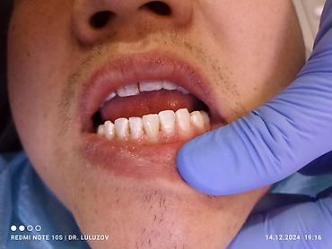 Медицинские услуги: Клиника | Стоматолог | Протезирование — 12