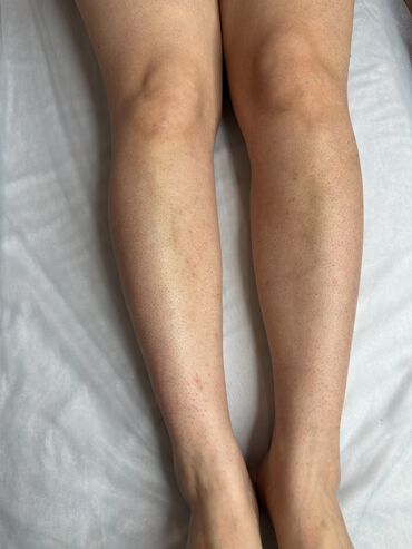 Эпиляция: Я мастер Ася 🍯 С опытом 3 года 🤝 Шугаринг Ламинирование бровей и — 8