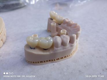 Медицинские услуги: Клиника | Стоматолог | Протезирование — 23