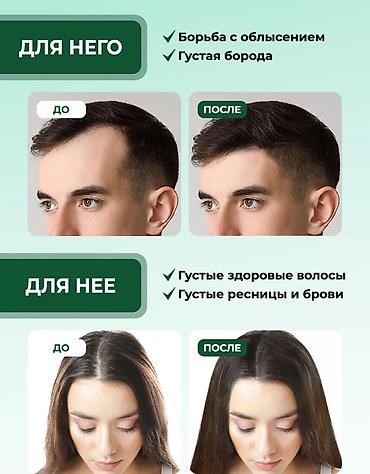 алое вера: Масло розмарина экстракт для волос — 4