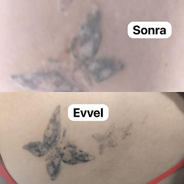 doyme sekilleri: Tatunuzun seklin gonderin qiymet deyilsin🤗3 seansa kimi lyuboy seansda — 3