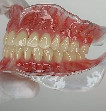 Красота и здоровье: Tam üst-alt protez dəsti – anatomik detallı, yüksək estetikalı - — 2