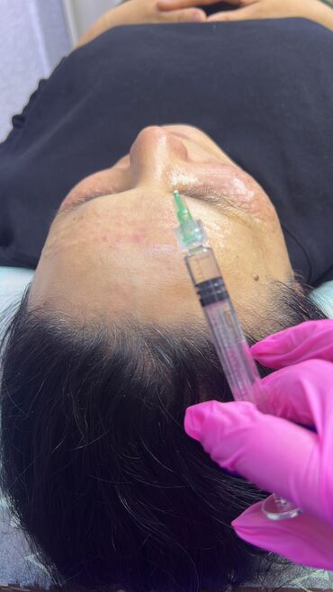 Косметология: Косметология, Биоревитализация, Ботокс, Демодекоз, Гипоаллергенные материалы, Консультация, Сертифицированный косметолог — 28