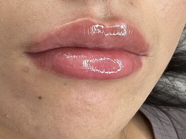 Косметология: Косметология, Ботокс, Биоревитализация, Ботулинотерапия, Консультация, Гипоаллергенные материалы, Сертифицированный косметолог — 30