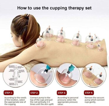 Lepota i zdravlje: Ventuze . CUPPING-fizikalna terapija-akupunktura- čašama Komplet za — 10