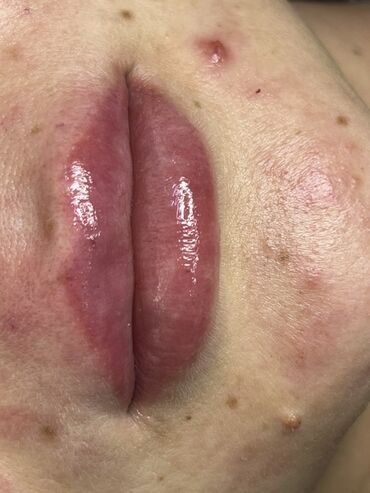 Косметика: Процедура перманентного макияжа губ позволяет придать губам желаемый — 9