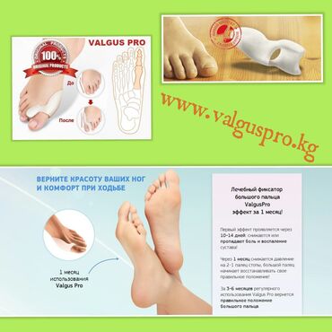 Медтовары: Корректоры для большого пальца ноги от вальгусной деформации(косточки