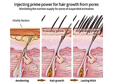 Уход за телом: ❄️ США имбирный шампунь против алопеции шампунь против облысения — 6