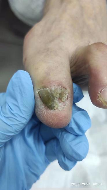 Маникюр: Ремонт сломаных ногтей, Наращивание ногтей, Донаращивание ногтей, Услуги подолога, Маникюр, Педикюр, Консультация, Одноразовые расходные материалы — 5