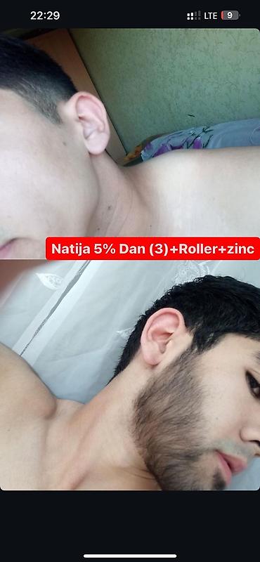 Уход за телом: Рост борода и волосы, киркланд оригинал✅из США оптом и розница +996 — 5