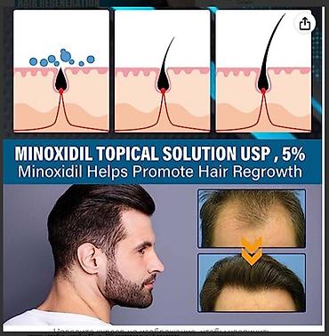 Уход за телом: США Миноксидил ОРИГИНАЛ от облысения ПЕНКА СПРЕЙ КОТОРУЮ НЕ — 9