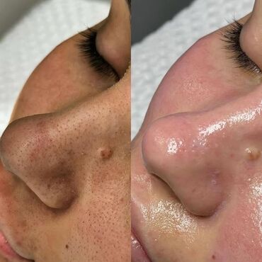 Косметология: Косметология, Пилинг, Ботулинотерапия, Плазмолифтинг, Консультация, Требуются модели, Сертифицированный косметолог — 3