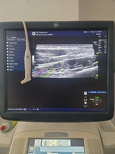 Другие медицинские товары: Линейный датчик GE L8-18i-D Год выпуска: 2013-07 В идеальном — 7