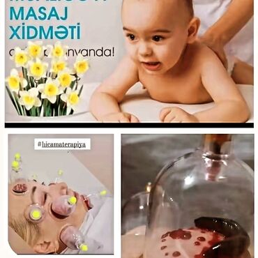 Hicama, zəli: Xidmət: Hicama, hirudoterapiya və masaj - Hicama terapiyası: Bədənin — 4