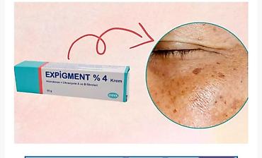 expigment: Üz kremi, Bütün dəri növləri üçün, 20 ml, Yeni, Ödənişli çatdırılma — 2