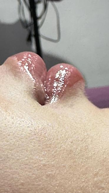 Косметология: Косметология, Увеличение губ, Гипоаллергенные материалы at lalafo.kg — 15 Косметология: Косметология, Увеличение губ, Гипоаллергенные материалы — 15