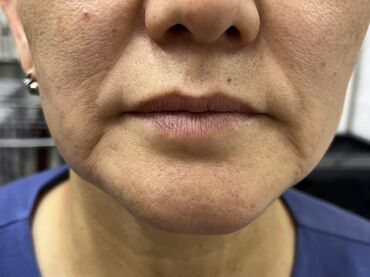 Косметология: Косметология, Маски, Мезотерапия, Удаление носогубных складок, Гипоаллергенные материалы, Консультация, Сертифицированный косметолог — 9