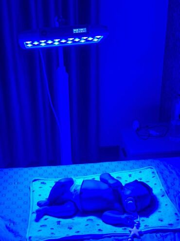 лампа для лечения желтухи новорожденных: Фотолампа.Самые мощные и эффективные диодные фотолампы для скорейшего