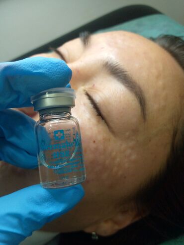 Косметология: Косметология, Биоревитализация, Ботулинотерапия, Контурное моделирование, Гипоаллергенные материалы, Консультация, Сертифицированный косметолог — 26