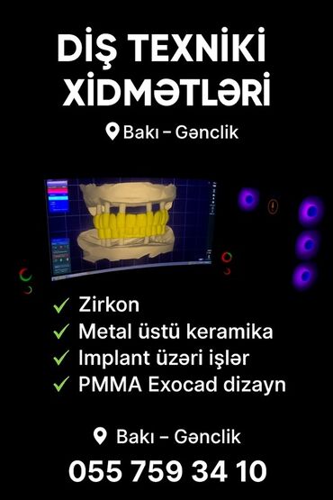 акция на установку брекетов: Diş texniki xidmətləri zirkon, metal üstü keramika, implant üzəri