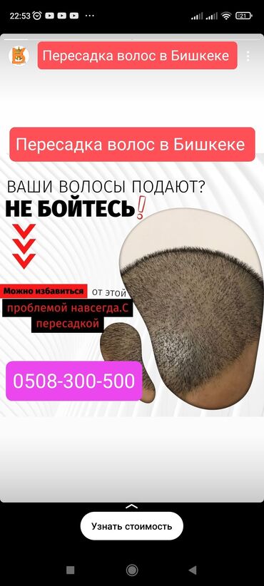 пересадка волос в оше: Пересадка волос в Бишкеке!!! Врачи из Турции занимается с пересадкой