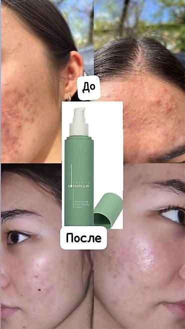 крем барои калон кардани сина: Essens Colostrum Nourishing Face & Body Cream — питательный крем — 4