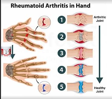 Уход за телом: Гель Германия согревающий\ обезбаливающий от боли в суставах и мышцах — 8
