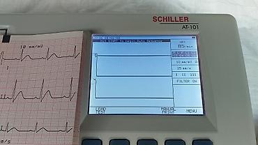 philips koncentrator kiseonika: EKG aparat Schiller Cardiovit AT-101
Polovno
Ispravno
Odličan — 7