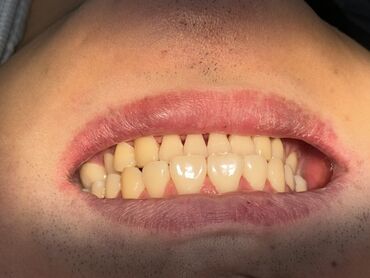 автоэлектрик ремонт авто с выездом бишкек: Стоматологические услуги: терапия, гигиена и эстетика ДЕЛАЕМ С ЛЮБОВЬЮ