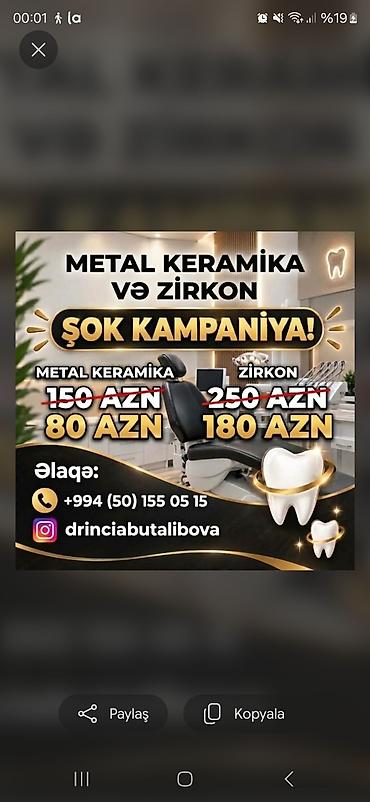 gümüş diş: Metal keramik və zirkon diş bərpaları üçün kampaniya! Təkliflər: - — 1