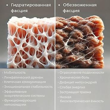 Аппараты для коррекции фигуры: Огненное одеяло (термосауна/термококон) - Назначение: интенсивный — 12