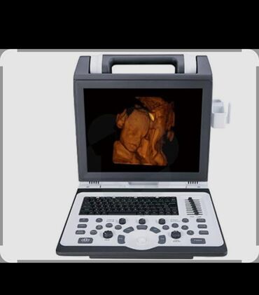 продажа медицинского оборудования: Срочно Продаю 3D / 4D УЗИ аппарат SIUI 8800 + 3 датчика (конвексный/
