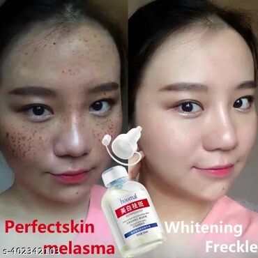 Косметика: От пигментации От пигментных пятен От веснушек Эссенция, поглощающая — 2