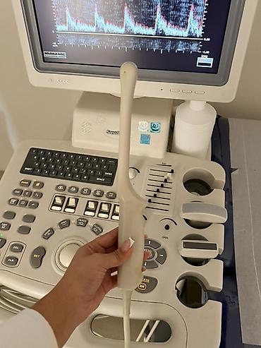 dinakort aparat: SinoSonic SonoScape SI-6000 ultrasəs diaqnostika aparatı — 6