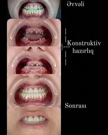 Stomatologiya: 💫Ramazan ayı ilə əlaqədar Kampaniya✨🌟⭐💫 🌊🔥Diş Həkimi 🔥🌊 Qiymətləri — 10