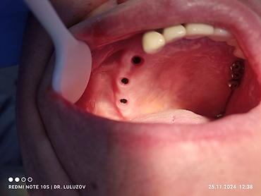 Медицинские услуги: Клиника | Стоматолог | Протезирование — 17