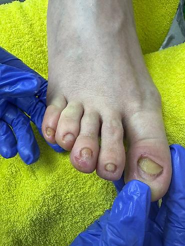 Маникюр: Коррекция вросших ногтей, Услуги подолога, Маникюр, Педикюр, Услуга в 4 руки, Одноразовые расходные материалы, Консультация — 13