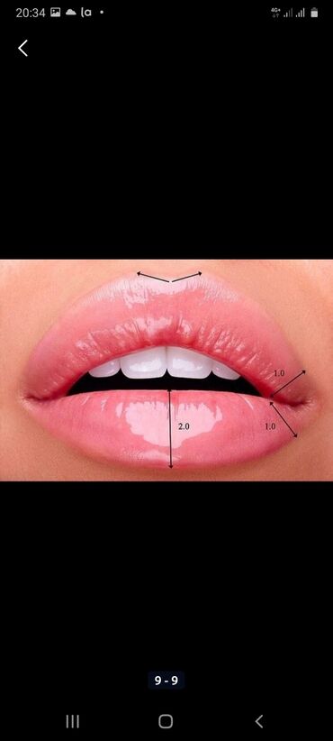 Косметология: Косметология, Биоревитализация, Ботулинотерапия, Контурное моделирование, Гипоаллергенные материалы, Консультация, Сертифицированный косметолог — 2