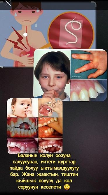 Другие принадлежности: Перчатка от сосания пальца — 6