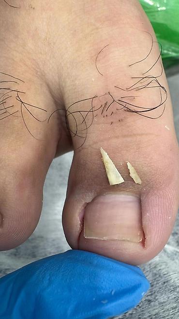 Маникюр: Коррекция вросших ногтей, Маникюр, Педикюр, Услуги подолога, С выездом на дом, Консультация, Одноразовые расходные материалы — 17