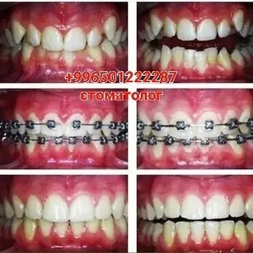 Услуги: Стоматолог | Реставрация, Протезирование, Чистка зубов | Круглосуточно