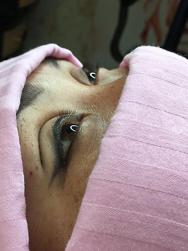 Косметология: Косметология, Ботокс, Биоревитализация, Ботулинотерапия, Консультация, Гипоаллергенные материалы, Сертифицированный косметолог — 13