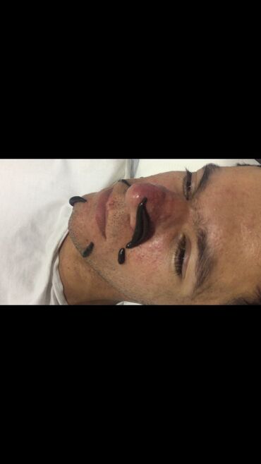 Kosmetologiya: Bəylər üçün = Lazer Epilasiyasi✅Hicama və — 14